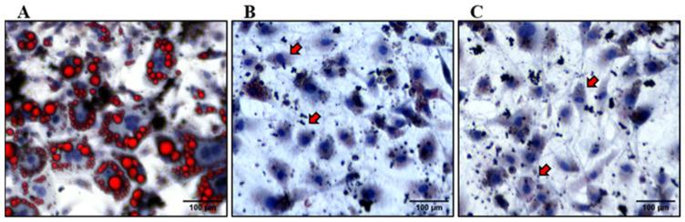https://cdn.ncbi.nlm.nih.gov/pmc/blobs/faef/11206641/a4c7508f9905/nutrients-16-01817-g003.jpg