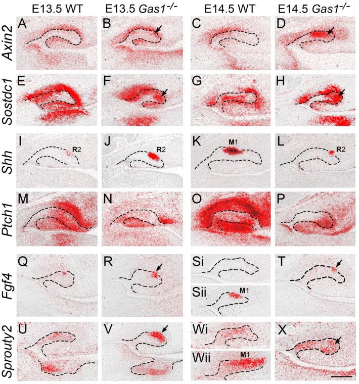 https://cdn.ncbi.nlm.nih.gov/pmc/blobs/faf1/8935464/595bf8b82cc7/10.1177_00220345211049403-fig3.jpg