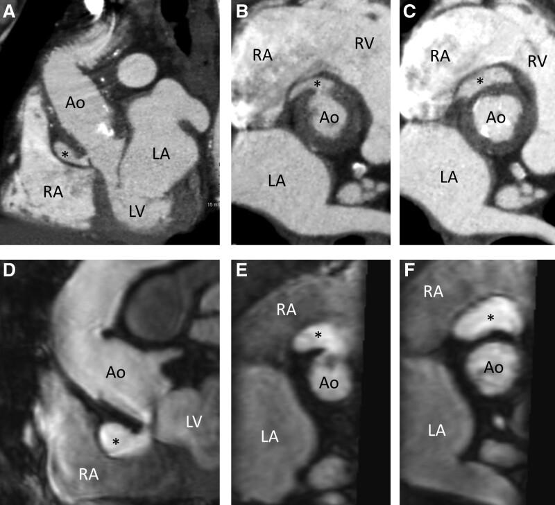 https://cdn.ncbi.nlm.nih.gov/pmc/blobs/faf2/10237692/6b98da94630f/medi-102-e33864-g001.jpg
