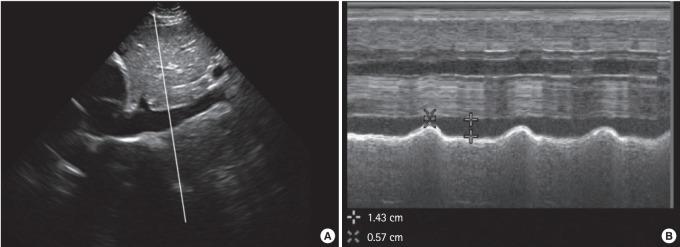 https://cdn.ncbi.nlm.nih.gov/pmc/blobs/faf2/5052829/c9a6159a000e/ceem-14-040f3.jpg