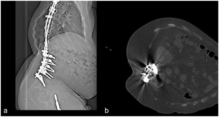 https://cdn.ncbi.nlm.nih.gov/pmc/blobs/faf4/6174643/96a6831c19e0/10.1177_1756286418803246-fig2.jpg