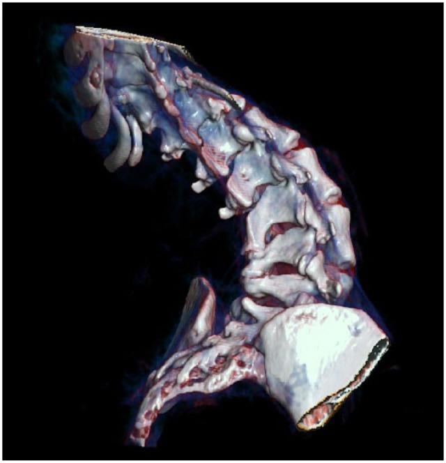 https://cdn.ncbi.nlm.nih.gov/pmc/blobs/faf4/6174643/b2c3a8e6b564/10.1177_1756286418803246-fig1.jpg