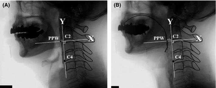 https://cdn.ncbi.nlm.nih.gov/pmc/blobs/faf7/7983890/a26faff33f34/JOOR-48-169-g001.jpg
