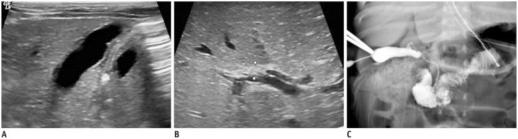 https://cdn.ncbi.nlm.nih.gov/pmc/blobs/fafb/4644760/6da64bb8cf65/kjr-16-1364-g004.jpg