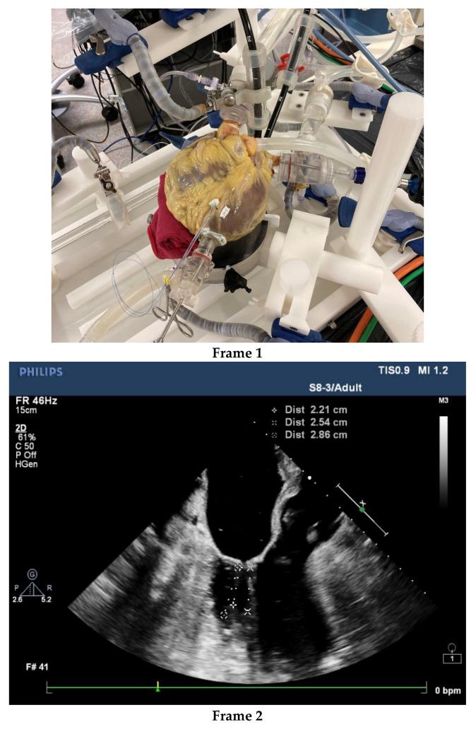 https://cdn.ncbi.nlm.nih.gov/pmc/blobs/fb00/9410306/3cc543bac1be/jcdd-09-00261-g002a.jpg
