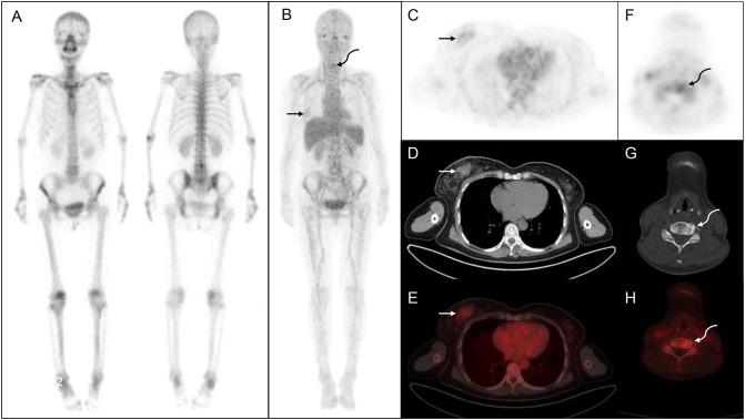 https://cdn.ncbi.nlm.nih.gov/pmc/blobs/fb01/11323743/d3468b09e825/fonc-14-1428498-g002.jpg