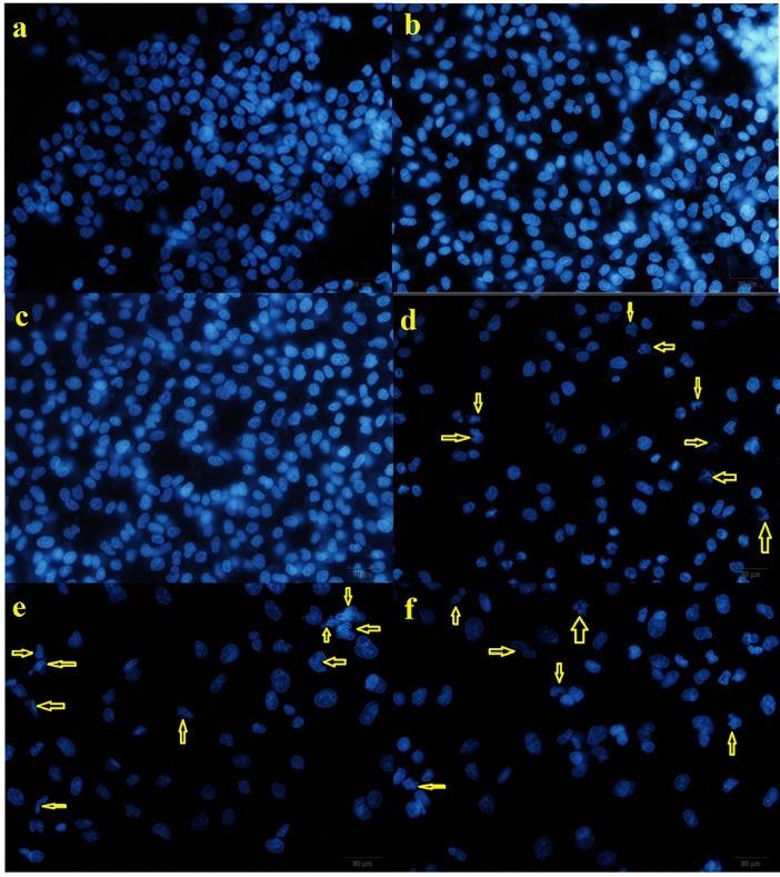 https://cdn.ncbi.nlm.nih.gov/pmc/blobs/fb04/6468221/45c3c5ef4ae8/apb-9-122-g008.jpg