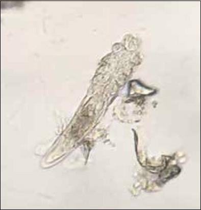https://cdn.ncbi.nlm.nih.gov/pmc/blobs/fb07/8743773/9504ea405b2c/Vetworld-14-2919-g002.jpg