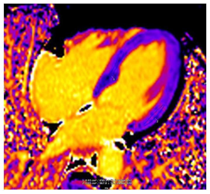 https://cdn.ncbi.nlm.nih.gov/pmc/blobs/fb0c/8124634/ebc4adcb5dc3/jcm-10-01994-g005.jpg