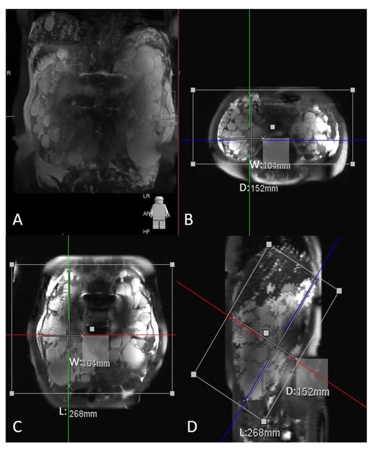 https://cdn.ncbi.nlm.nih.gov/pmc/blobs/fb0d/8947181/78e0508581aa/diagnostics-12-00755-g002.jpg
