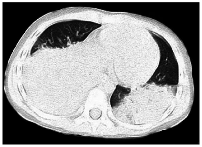 https://cdn.ncbi.nlm.nih.gov/pmc/blobs/fb10/7818525/55ff9870d1a8/etm-21-03-09634-g00.jpg