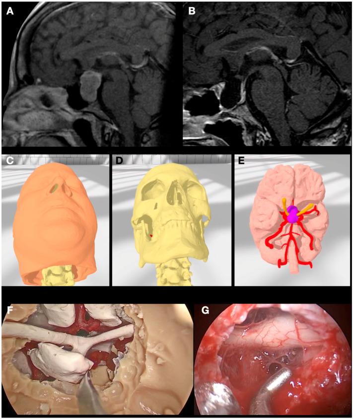 https://cdn.ncbi.nlm.nih.gov/pmc/blobs/fb14/10890029/88201002fea9/jpm-14-00187-g003.jpg