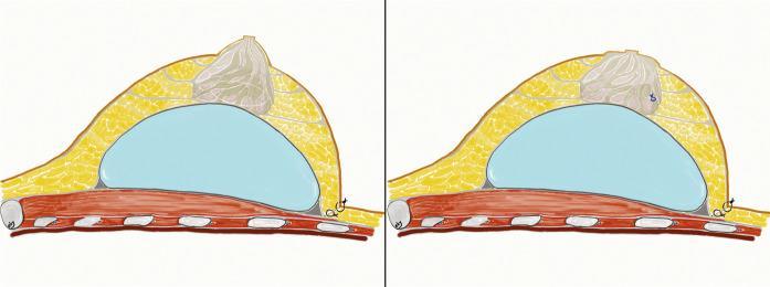 https://cdn.ncbi.nlm.nih.gov/pmc/blobs/fb16/10081475/2e5cccc01bf1/JCAS-15-412-g002.jpg