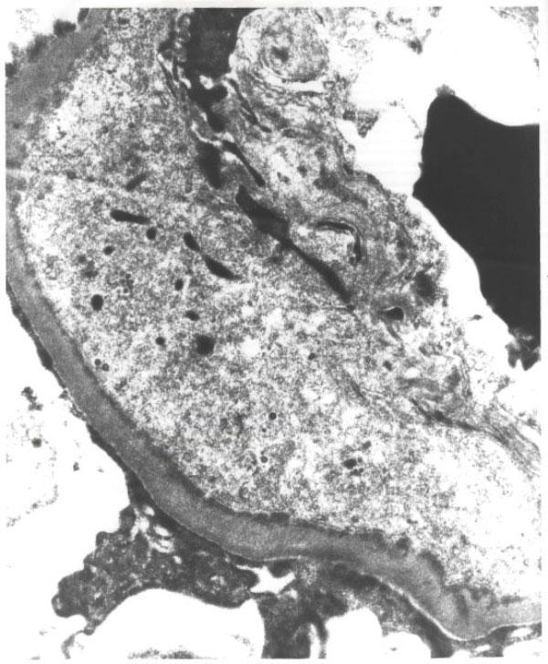https://cdn.ncbi.nlm.nih.gov/pmc/blobs/fb19/2827065/3a8d3ef9cfc8/1757-1626-0002-0000007201-1.jpg
