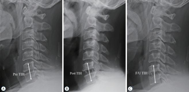 https://cdn.ncbi.nlm.nih.gov/pmc/blobs/fb19/8752891/ad9d745de3c6/jkns-2021-0131f6.jpg