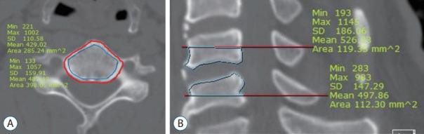 https://cdn.ncbi.nlm.nih.gov/pmc/blobs/fb19/8752891/dedcd191381e/jkns-2021-0131f3.jpg