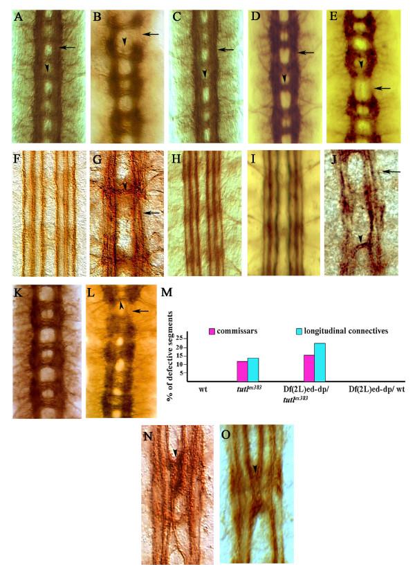 https://cdn.ncbi.nlm.nih.gov/pmc/blobs/fb33/2739522/14e7b695b3a3/1749-8104-4-31-2.jpg