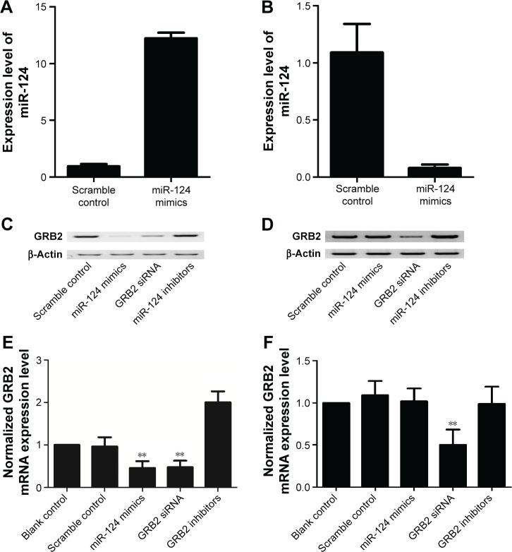 https://cdn.ncbi.nlm.nih.gov/pmc/blobs/fb34/5422315/5e021203c058/copd-12-1351Fig6.jpg