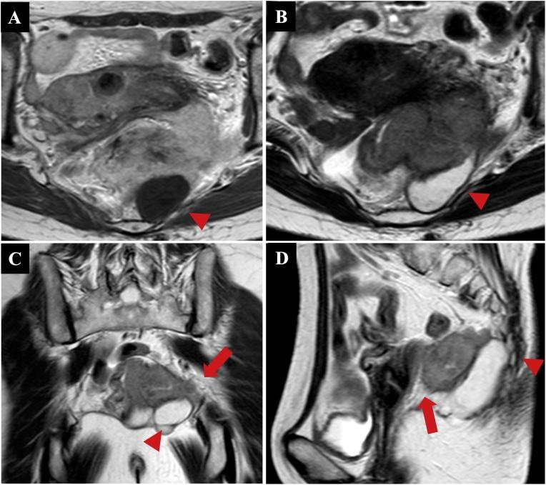 https://cdn.ncbi.nlm.nih.gov/pmc/blobs/fb44/6939061/1fcdd3a116b8/gr3.jpg
