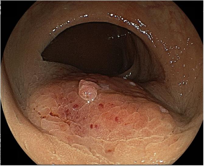 https://cdn.ncbi.nlm.nih.gov/pmc/blobs/fb44/6939061/7026ef3d9116/gr1.jpg