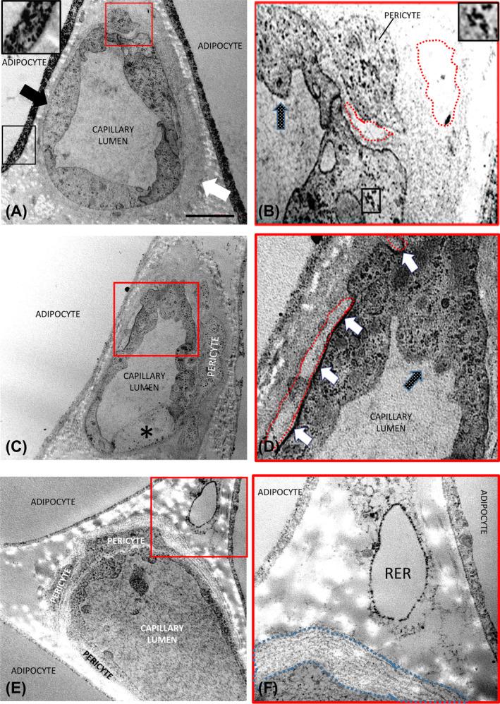 https://cdn.ncbi.nlm.nih.gov/pmc/blobs/fb46/11937865/3dd8f18beef0/OBY-33-695-g004.jpg