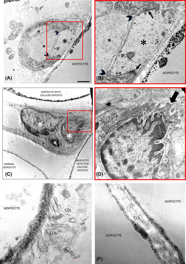 https://cdn.ncbi.nlm.nih.gov/pmc/blobs/fb46/11937865/cbc1c23615a1/OBY-33-695-g001.jpg