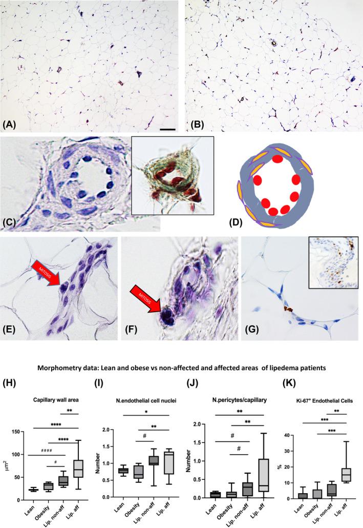https://cdn.ncbi.nlm.nih.gov/pmc/blobs/fb46/11937865/ce598d6f0672/OBY-33-695-g003.jpg