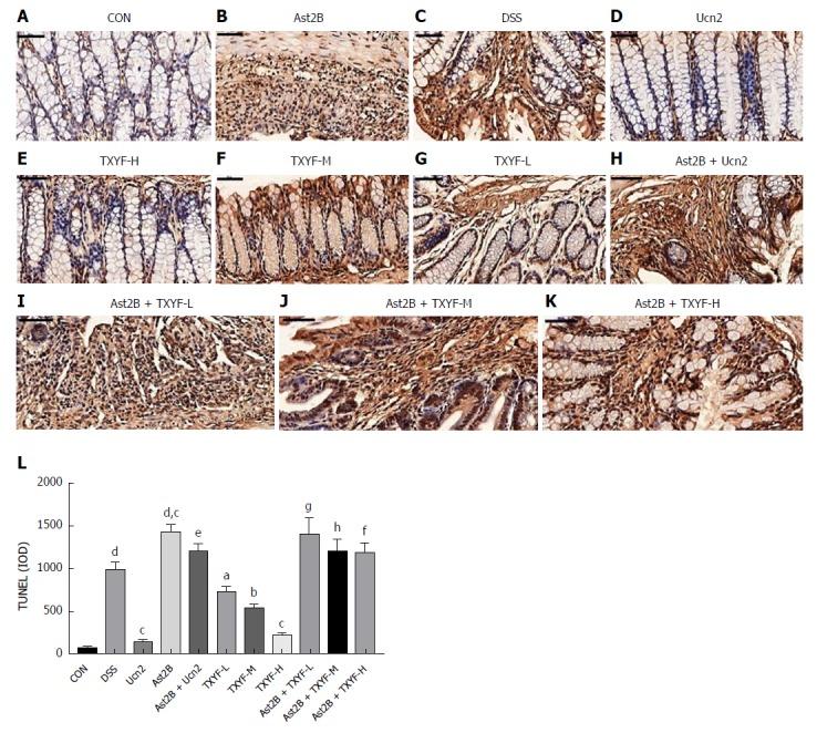 https://cdn.ncbi.nlm.nih.gov/pmc/blobs/fb4a/5922995/18e7a5e08c35/WJG-24-1766-g004.jpg