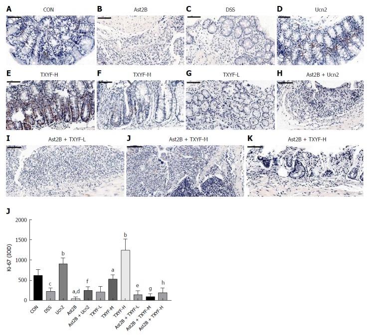 https://cdn.ncbi.nlm.nih.gov/pmc/blobs/fb4a/5922995/f6dc7c4ad520/WJG-24-1766-g005.jpg