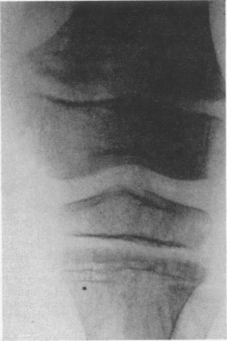 https://cdn.ncbi.nlm.nih.gov/pmc/blobs/fb52/1870355/7134ada47c98/procrsmed00246-0122-a.jpg