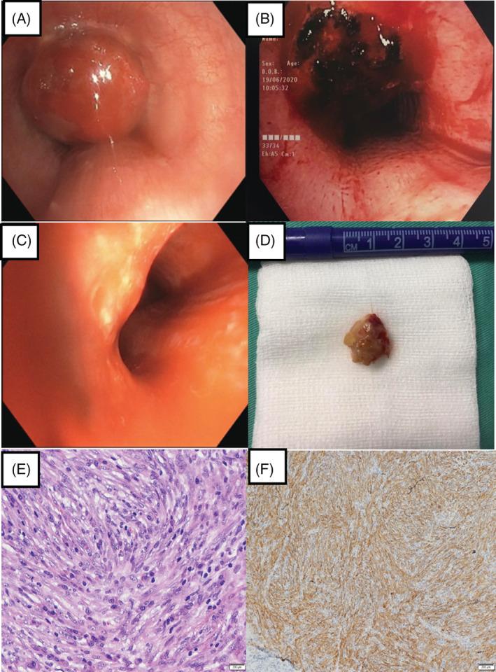 https://cdn.ncbi.nlm.nih.gov/pmc/blobs/fb55/9174595/9a3e63a18f3a/RCR2-10-e0984-g003.jpg