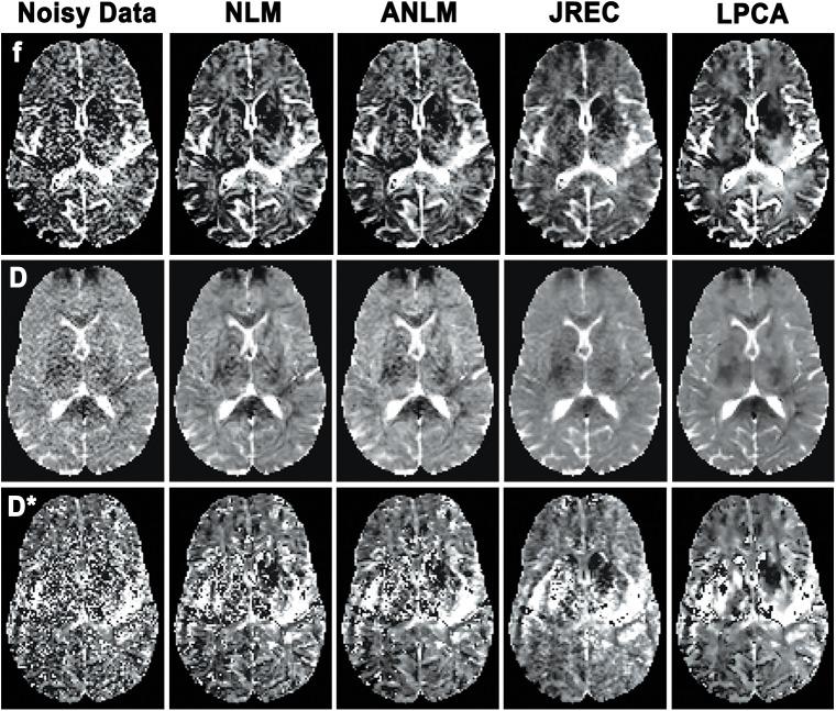 https://cdn.ncbi.nlm.nih.gov/pmc/blobs/fb5d/5381911/4066b66cdb82/pone.0175106.g007.jpg