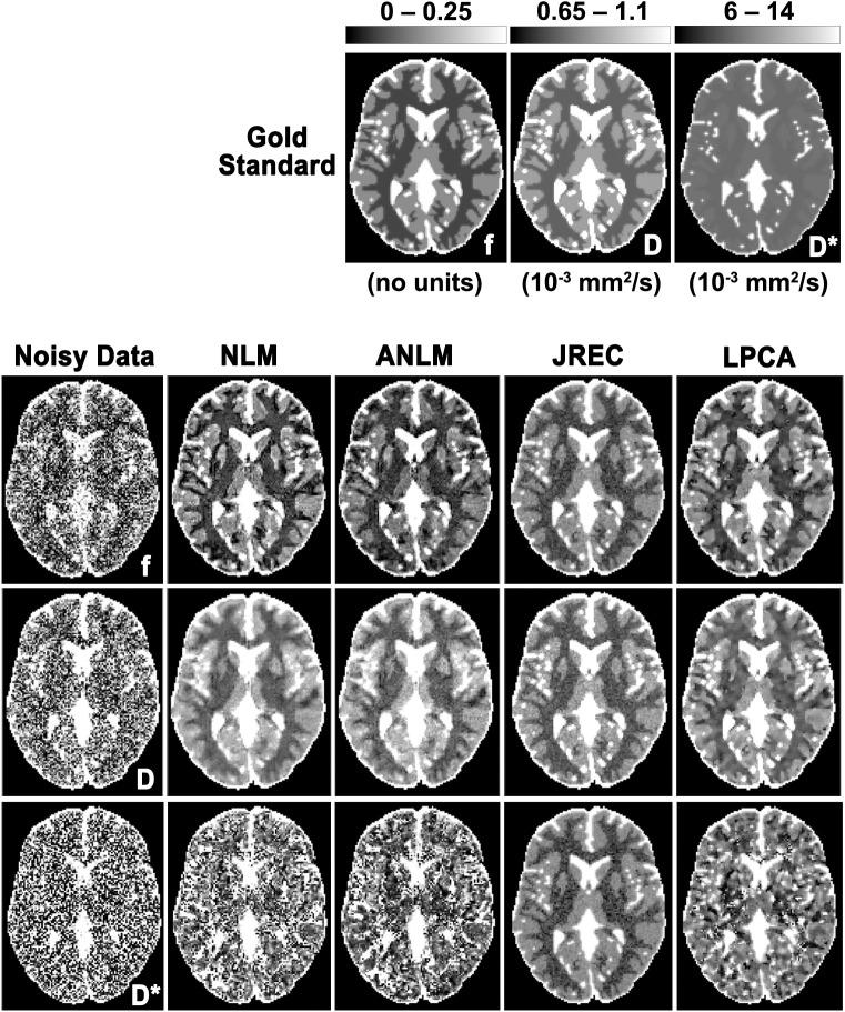 https://cdn.ncbi.nlm.nih.gov/pmc/blobs/fb5d/5381911/ce4951d52acb/pone.0175106.g001.jpg