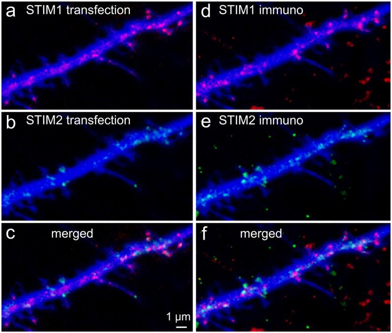 https://cdn.ncbi.nlm.nih.gov/pmc/blobs/fb5f/7813759/68ea13a90949/fnsyn-12-573714-g0001.jpg