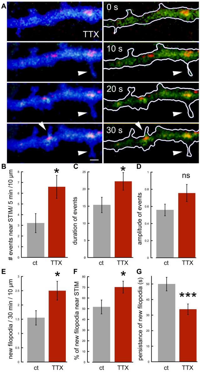 https://cdn.ncbi.nlm.nih.gov/pmc/blobs/fb5f/7813759/93306aa9cf24/fnsyn-12-573714-g0006.jpg