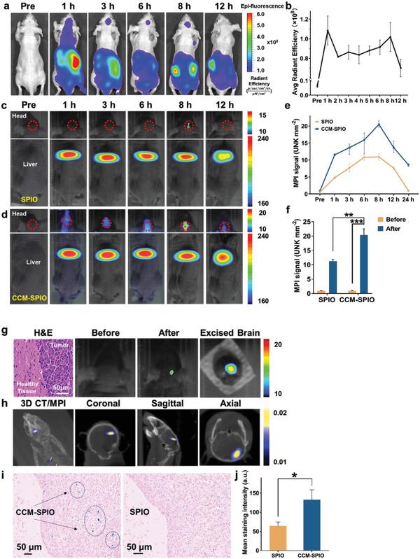 https://cdn.ncbi.nlm.nih.gov/pmc/blobs/fb60/10323639/026d12d3a2cb/ADVS-10-2300854-g007.jpg