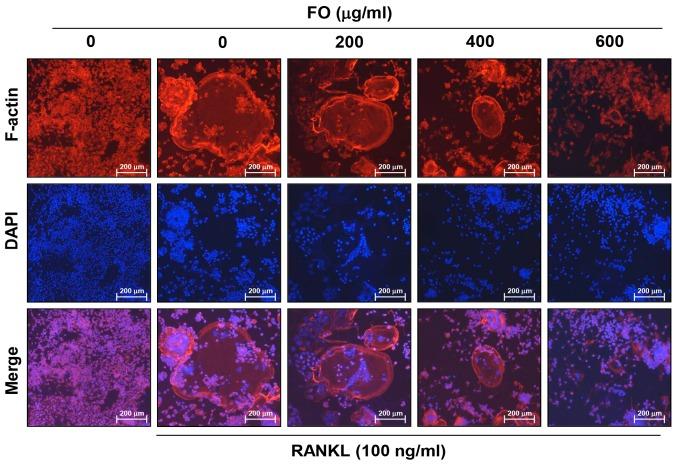https://cdn.ncbi.nlm.nih.gov/pmc/blobs/fb67/6471417/e9daac03cd5e/ijms-20-01439-g003.jpg