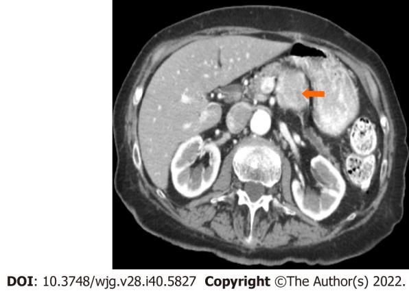 https://cdn.ncbi.nlm.nih.gov/pmc/blobs/fb6b/9639656/0060efe15698/WJG-28-5827-g004.jpg
