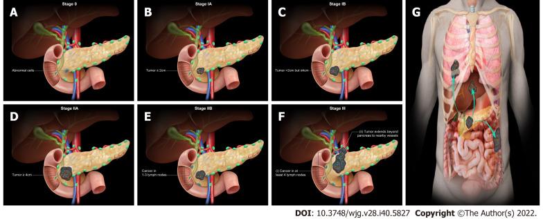 https://cdn.ncbi.nlm.nih.gov/pmc/blobs/fb6b/9639656/815e7c4b7e46/WJG-28-5827-g002.jpg