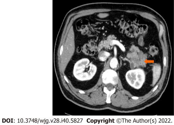 https://cdn.ncbi.nlm.nih.gov/pmc/blobs/fb6b/9639656/a91cf8ad85a5/WJG-28-5827-g005.jpg