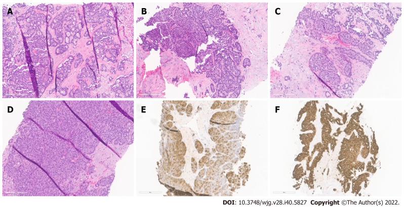 https://cdn.ncbi.nlm.nih.gov/pmc/blobs/fb6b/9639656/eeaa8368c60c/WJG-28-5827-g001.jpg