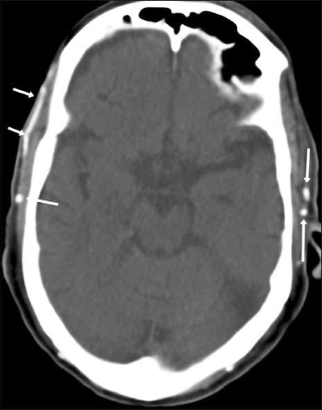 https://cdn.ncbi.nlm.nih.gov/pmc/blobs/fb71/3190495/4529cfb10189/IJRI-21-215-g001.jpg