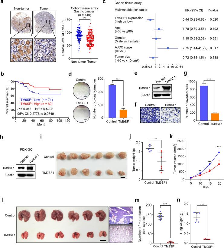 https://cdn.ncbi.nlm.nih.gov/pmc/blobs/fb73/9124189/196cc27641dc/41421_2022_395_Fig5_HTML.jpg