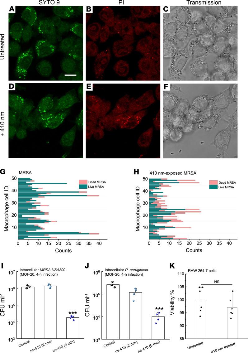 https://cdn.ncbi.nlm.nih.gov/pmc/blobs/fb80/9220836/3393dac7ae64/jciinsight-7-153079-g082.jpg