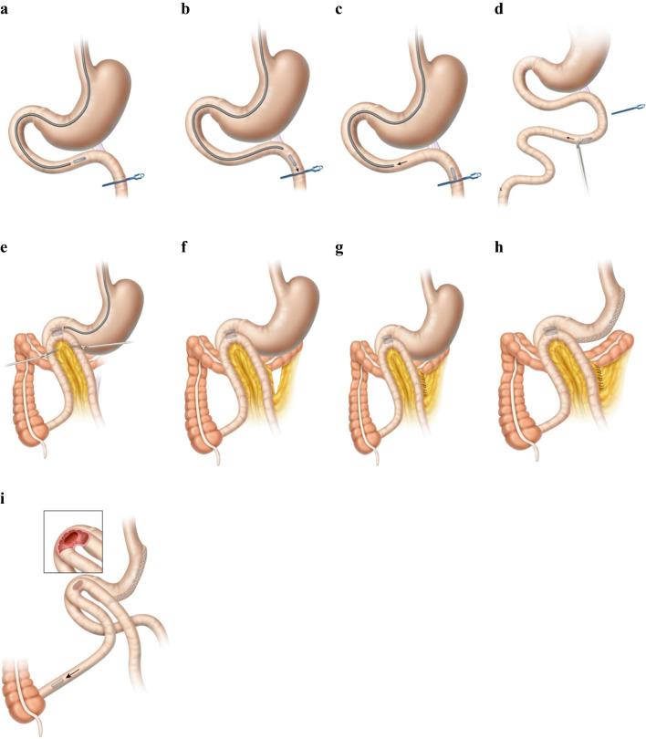 https://cdn.ncbi.nlm.nih.gov/pmc/blobs/fb91/10345004/25805dddf561/11695_2023_6708_Fig2_HTML.jpg