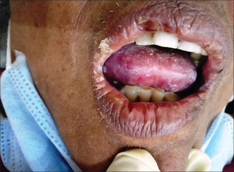 https://cdn.ncbi.nlm.nih.gov/pmc/blobs/fb9c/12283046/53868778b509/JOMFP-29-222-g001.jpg