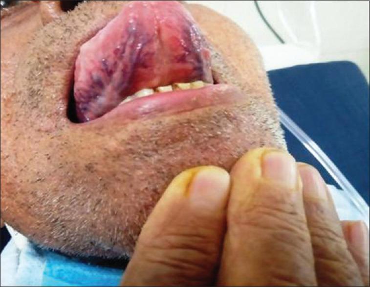 https://cdn.ncbi.nlm.nih.gov/pmc/blobs/fb9c/12283046/8bc0fa8710d3/JOMFP-29-222-g002.jpg