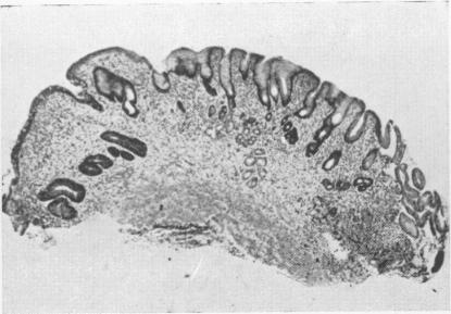 https://cdn.ncbi.nlm.nih.gov/pmc/blobs/fba1/2482063/7d267ebfd168/postmedj00481-0037-a.jpg