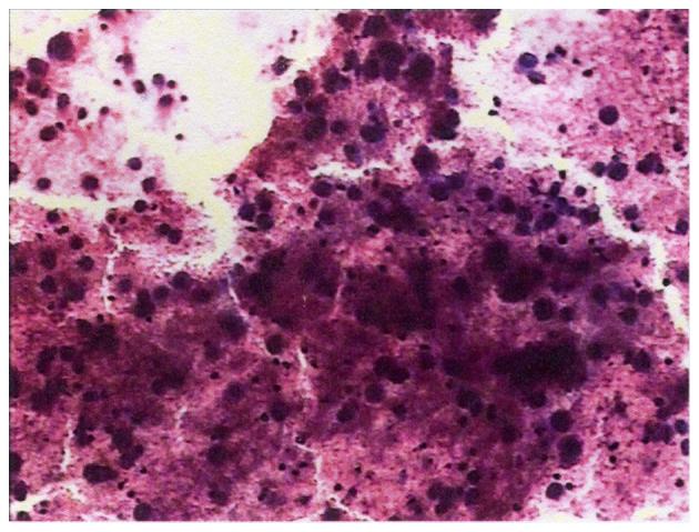 https://cdn.ncbi.nlm.nih.gov/pmc/blobs/fba1/4950166/6286a9c9700f/ol-12-02-0918-g01.jpg