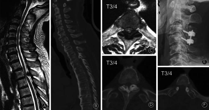 https://cdn.ncbi.nlm.nih.gov/pmc/blobs/fba5/7957417/ee8d1012e878/OS-13-537-g002.jpg